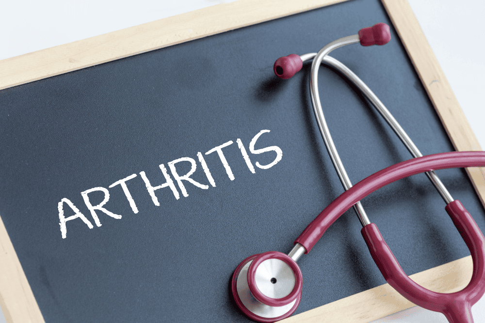 Artritis genezen?