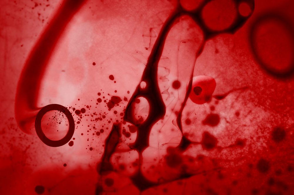 Vernauwing van de aorta