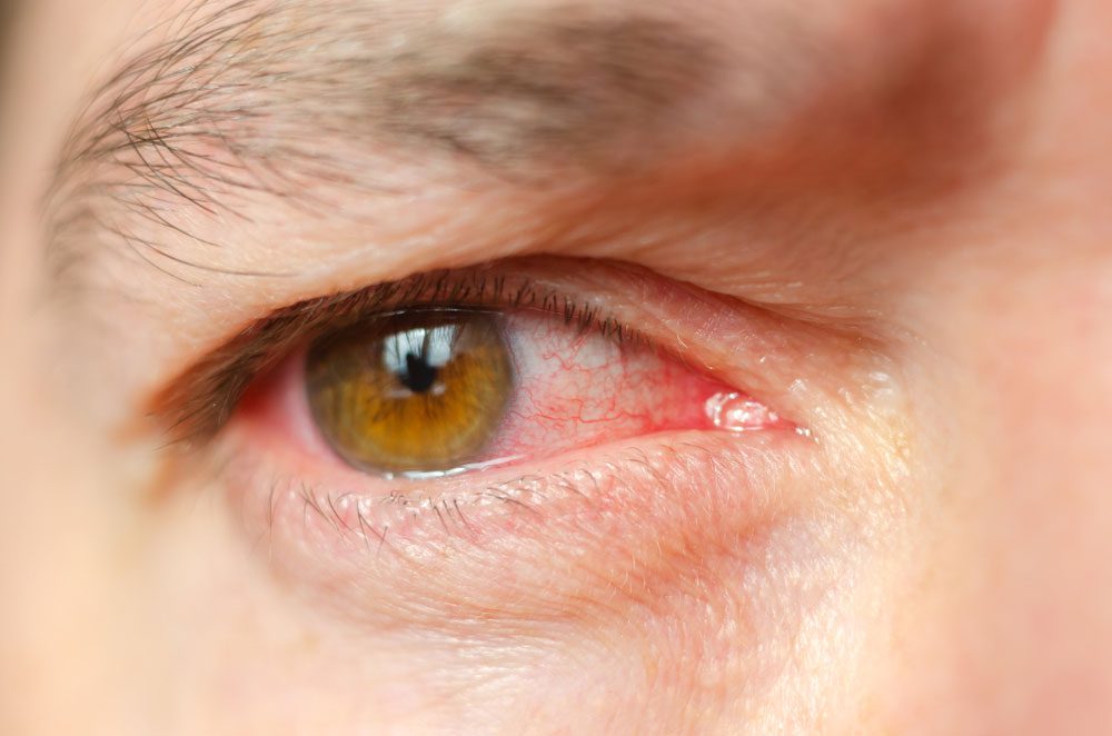 zicht-oog