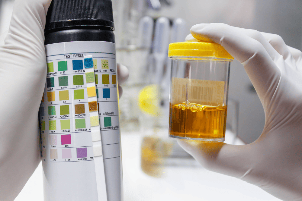 urine