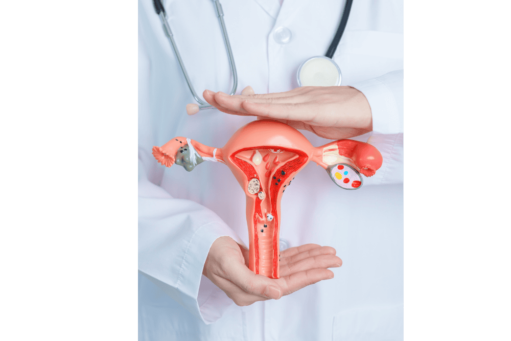 Gezonde voeding voor endometriose - groenten omega-3 vezels
