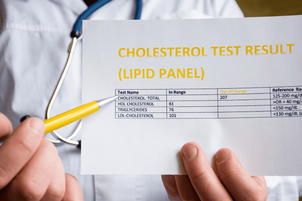 Nieuwe Cholesterol richtlijnen